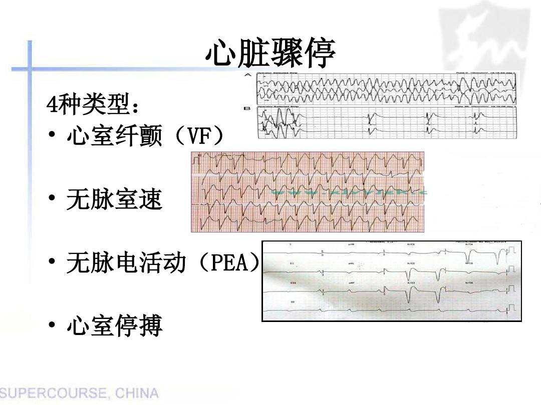 AED真是救命神器