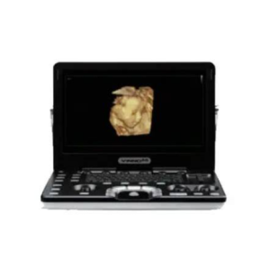 飞依诺 便携式数字化彩色超声诊断仪 VINNO 5-AED除颤器产品网